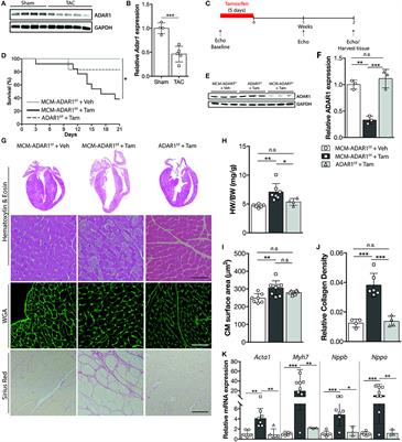 Cardiomyocyte Specific Deletion of ADAR1 Causes Severe Cardiac Dysfunction and Increased Lethality